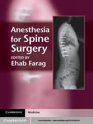 Anesthesia for Spine Surgery