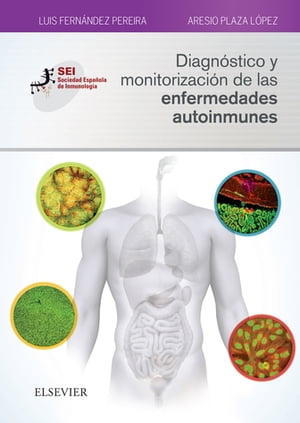 Diagn?stico y monitorizaci?n de las enfermedades autoinmunes Sociedad Espa?ola de Inmunolog?aŻҽҡ