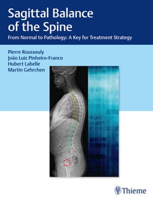 Sagittal Balance of the Spine