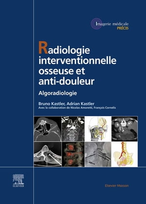 Radiologie Interventionnelle osseuse et anti-douleur