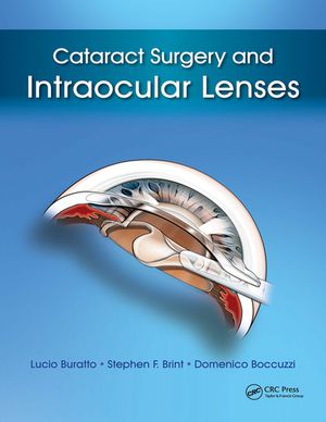 楽天楽天Kobo電子書籍ストアCataract Surgery and Intraocular Lenses【電子書籍】[ Lucio Buratto ]