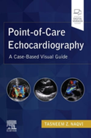 Point-of-Care Echocardiography, E-Book