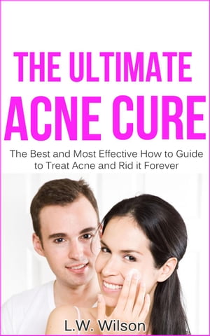 The Ultimate Acne Cure - The Best and Most Effective How to Guide to Treat Acne and Rid it Forever (acne no more, acne treatment, acne scar, acne cure, ... clear skin, sunshine hormone, skincare,) acne no more, acne treatment, acne scar,【電子書籍】