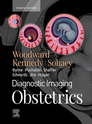Diagnostic Imaging: Obstetrics E-Book Diagnostic Imaging: Obstetrics E-Book【電子書籍】 Paula J. Woodward, MD