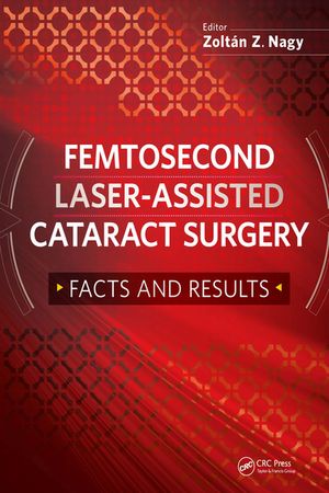 楽天楽天Kobo電子書籍ストアFemtosecond Laser-Assisted Cataract Surgery Facts and Results【電子書籍】[ Zoltan Nagy ]