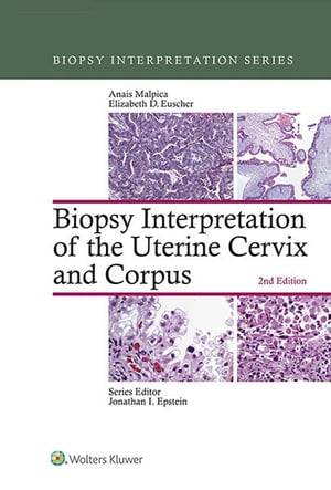 Biopsy Interpretation of the Uterine Cervix and Corpus