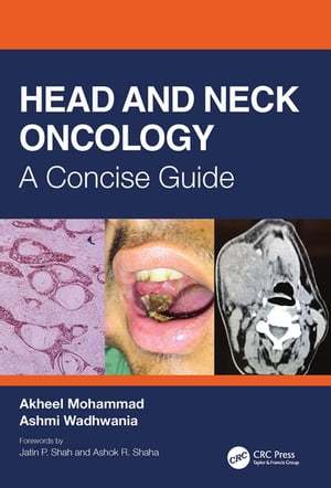 Head and Neck Oncology