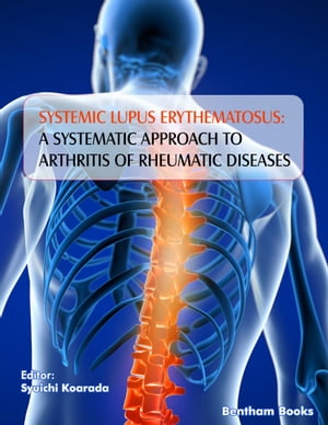 Systemic Lupus Erythematosus: A Systematic Approach to Arthritis of Rheumatic Diseases Frontiers in Arthritis