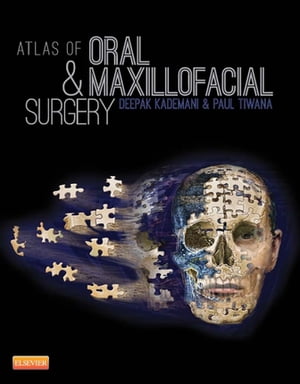 Atlas of Oral and Maxillofacial Surgery【電子書籍】[ Paul Tiwana ]