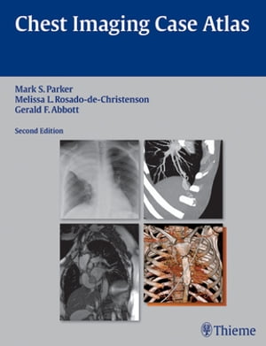 Chest Imaging Case Atlas【電子書籍】[ Mark S. Parker ]