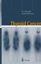 Thyroid Cancer【電子書籍】