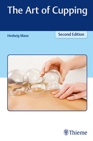 The Art of Cupping【電子書籍】 Hedwig Manz