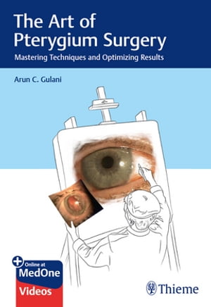 The Art of Pterygium Surgery