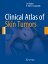 Clinical Atlas of Skin Tumors