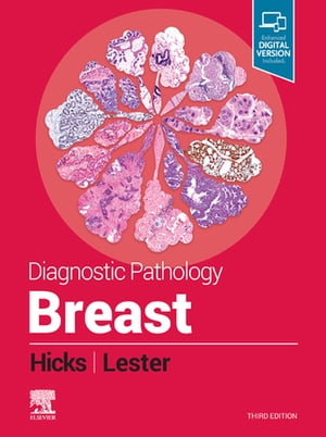 Diagnostic Pathology: Breast, E-Book