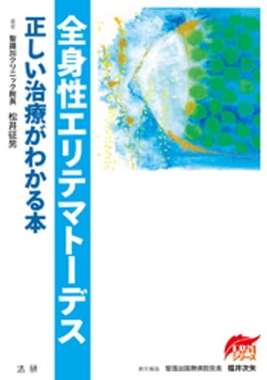 全身性エリテマトーデス : 正しい治療がわかる本
