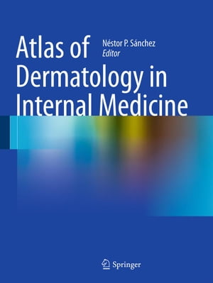 Atlas of Dermatology in Internal Medicine