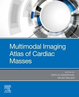 Multimodal Imaging Atlas of Cardiac Masses - E-Book