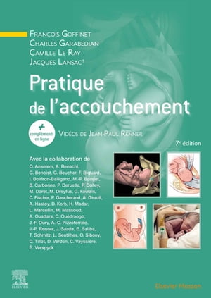 Pratique de l'accouchement