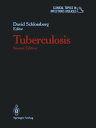 ＜p＞Completely revised and updated, this comprehensive resource covers the epidemiology, pathogenesis, varied clinical manifestations, treatment and prevention of tuberculosis. All of the extra-pulmonary as well as pulmonary manifestations of tuberculosis are covered. Atypical mycobacterial infection is detailed. A special feature of this second edition is the new material on AIDS, which is now known to be complicated by tuberculosis infection.＜/p＞画面が切り替わりますので、しばらくお待ち下さい。 ※ご購入は、楽天kobo商品ページからお願いします。※切り替わらない場合は、こちら をクリックして下さい。 ※このページからは注文できません。