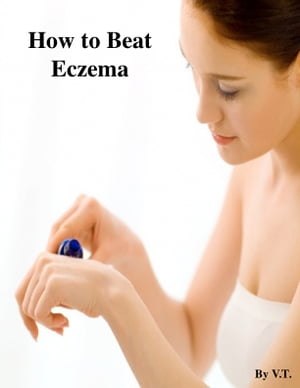 Cure Your Eczema Permanently