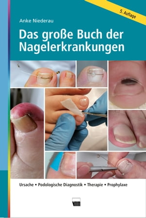 Das gro?e Buch der Nagelerkrankungen Ursache, Podologische Diagnostik, Therapie, Prophylaxe【電子書籍】[ Anke Niederau ]