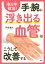 「老け手」解消！ 手・腕に浮き出る血管はこうして改善する