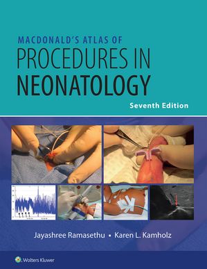 MacDonald’s Atlas of Procedures in Neonatology eBook without Multimedia