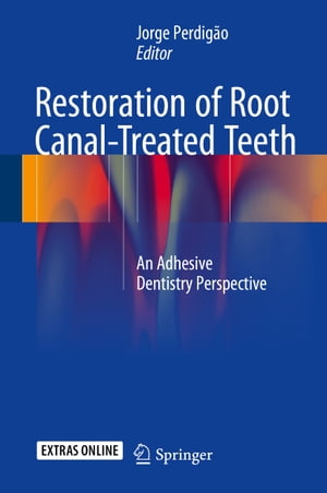 Restoration of Root Canal-Treated Teeth An Adhesive Dentistry PerspectiveŻҽҡ