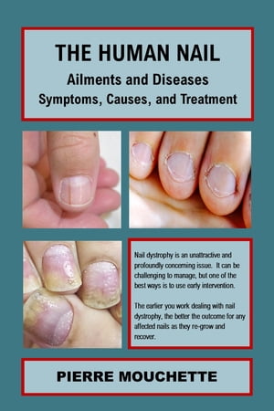 The Human Nail - Ailments and Diseases Symptoms, Causes, and Treatment【電子書籍】[ Pierre Mouch..