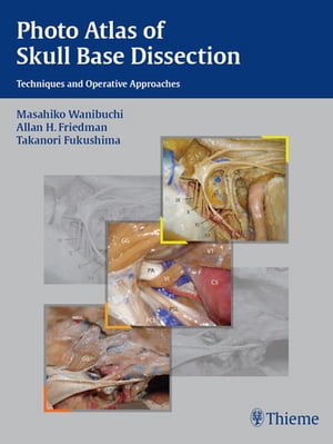 Photo Atlas of Skull Base Dissection