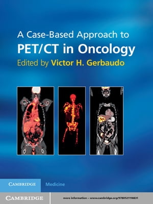 A Case-Based Approach to PET/CT in Oncology