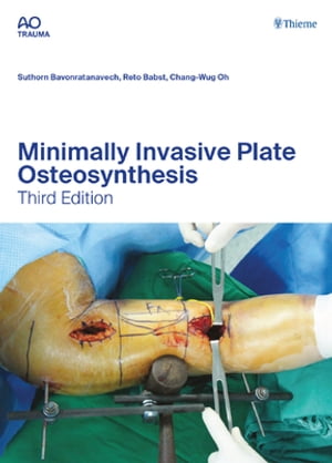 Minimally Invasive Plate Osteosynthesis【電子書籍】