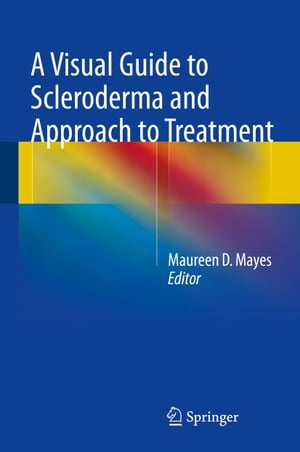 A Visual Guide to Scleroderma and Approach to Treatment【電子書籍】
