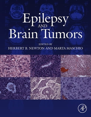 Epilepsy and Brain Tumors【電子書籍】