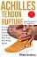 ACHILLES TENDON RUPTURE HEEL SUPPORT FOR BEGINNERS