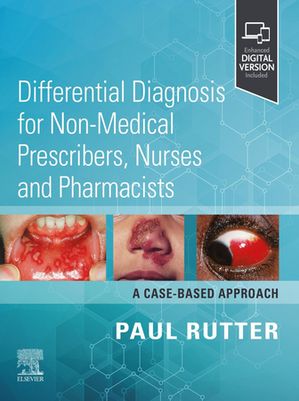 Differential Diagnosis for Non-medical Prescribers, Nurses and Pharmacists: A Case-Based Approach - E-BOOK