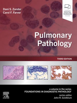 Pulmonary Pathology E-Book
