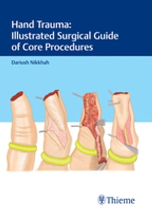 Hand Trauma: Illustrated Surgical Guide of Core Procedures