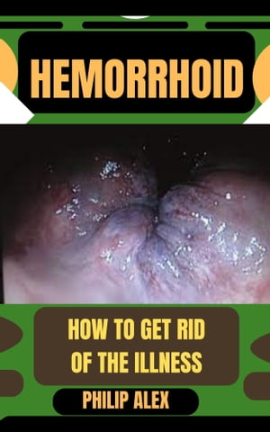 HEMORRHOID HOW TO GET RID OF THE ILLNESS【電子書籍】[ PHILIP ALEX ]