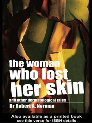 The Woman Who Lost Her Skin