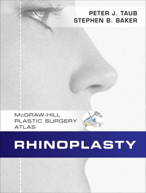 Rhinoplasty