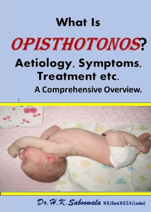 What Is Opisthotonos? Causes, Symptoms, Treatment etc. A Comprehensive Overview.,