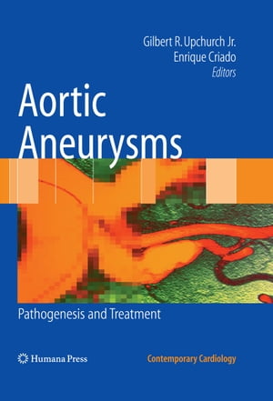 Aortic Aneurysms Pathogenesis and Treatment
