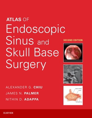 Atlas of Endoscopic Sinus and Skull Base Surgery E-Book