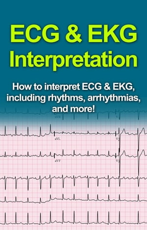 ECG & EKG Interpretation