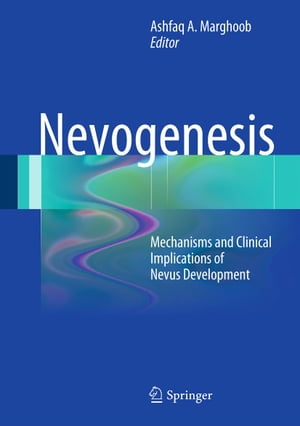 Nevogenesis