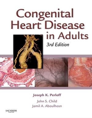 Congenital Heart Disease in Adults