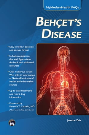 Behcet’s Disease