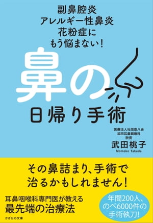 副鼻腔炎 アレルギー性鼻炎 花粉症にもう悩まない！ 鼻の日帰り手術【電子書籍】[ 武田 桃子 ]